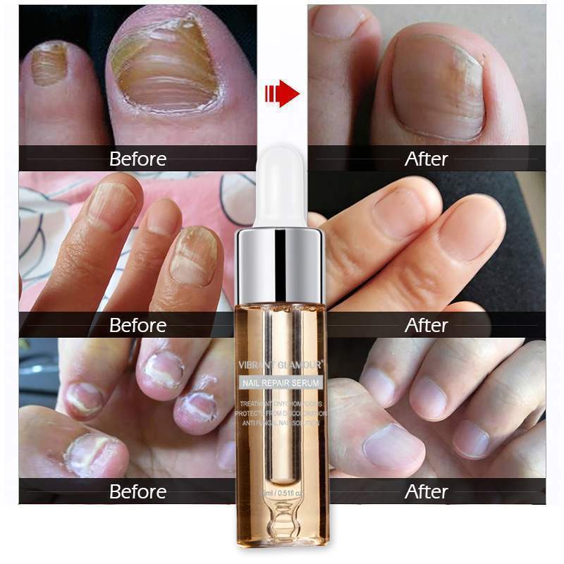 Vibrant Glamour Nail Repair Serum – Strengthen & Restore Your Nails